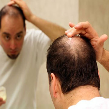 बालों को झड़ने से रोकने के घरेलू नुस्खे और बालो को उगाने के उपाय