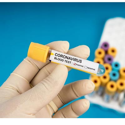 Coronavirus: संक्रमित लोगों की संख्या बढ़कर 519 हुई