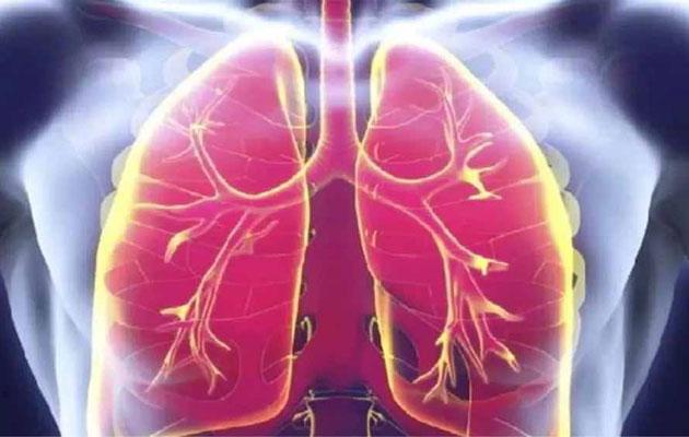 मध्य प्रदेश में इस जानलेवा बीमारी ने फैलाई दहशत, ऐसे लक्षण दिखें तो तुरंत हो जाएं अलर्ट